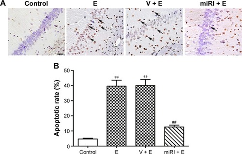Figure 3 miR-210 inhibitor prohibited epilepsy-induced neuronal apoptosis.