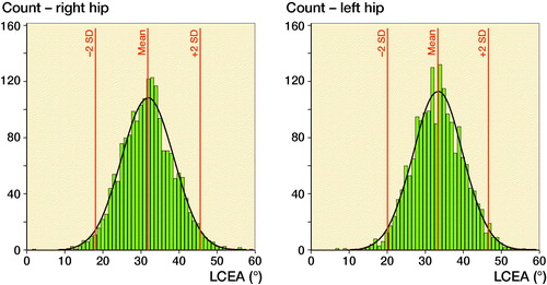 Figure 3. Distribution of the right and left LCEA in 1,870 adults. For right hips, the mean LCEA was 32 (SD 6.9) and the range of 2 SDs 18.1–45.6. For left hips, the mean LCEA was 33 (SD 6.6) and the range of 2 SDs 20.2–46.7.