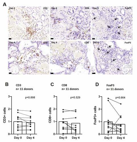 Figure 1. Preservation of t-lymphocytes in PDTC of GC and EGJC after 4 days (a) Representative images of immunohistochemical staining, showing t-lymphocytes (CD3), cytotoxic t-lymphocytes (CD8) and regulatory t-lymphocytes (FoxP3) at day 0 and after 4 days of cultivation. (b) Quantification of DAB stainings for t-lymphocytes (CD3) and (c, d) subtypes (CD8, FoxP3) at day 0 compared to 4 days ex vivo. Matched tissue specimens of 11 specimen donors were analyzed. Mann-Whitney-U test (P ≤ 0,05) showed no significant change of t-lymphocyte amounts. Day 0 normalized to 1; bars = 40 µm; error bars: SEM