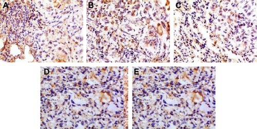 Figure 15 Immunohistochemical staining for P53 of orthotopic tumors in all the groups.Notes: (A) Positive group, (B) combination group, (C) test group, (D) reference group, and (E) model group. Magnification ×400.