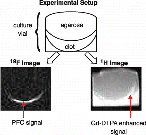 Figure 2. (top) Experimental imaging setup. (bottom, left) 19F image of an in vitro clot treated with paramagnetic, pefluoro‐15‐crown‐5 nanoparticles. (bottom, right) 1H image of the same slice. (View this art in color at www.dekker.com.)