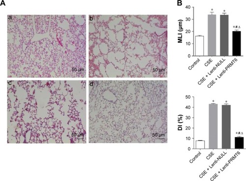 Figure 2 Histological examination of mouse lungs.