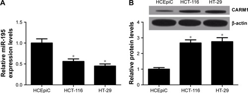 Figure 1 The expression of miR-195 and CARM1 in CRC cell lines HCT-116 and HT-29.