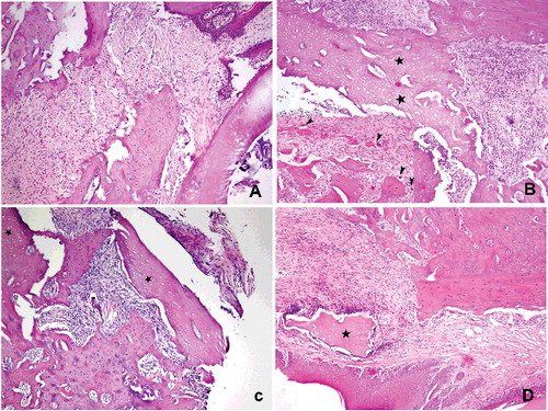 Figure 2. Histopathological view showing the normal and necrotic bone areas on the jaws: (A) control, normal bone cellularity, (B and C) Groups I and II, large necrotic areas (stars) bone, apoptotic osteoclasts with condensate nuclei (arrowhead), (D) Group III, small amounts of necrotic bone, control like histological features (HE, 100×).