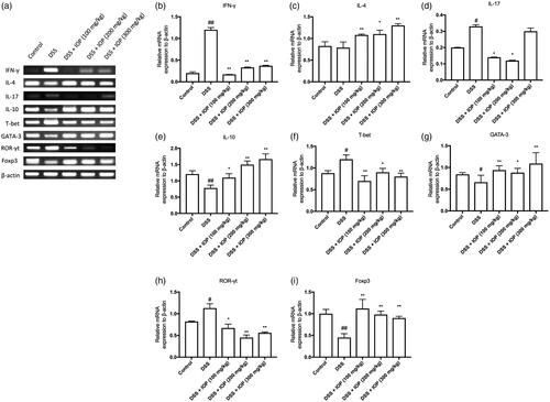 Figure 4. IOP regulated mRNA levels of Th1-, Th2-, Th17-, Treg-related cytokines and transcription factors in colon tissue. (a) Related cytokines and transcription factors mRNA expression. (b,f) Statistics of Th1-related IFN-γ and transcription T-bet. (c,g) Statistics of Th2-related IL-4 and transcription factors GATA-3. (d,h) Statistics of Th17-related IL-17 and transcription factor ROR-γt. (e,i) Statistics of Treg-related IL-10 and transcription factor Foxp3. *p < .05, **p < .01 compared with model group; #p < .05, #p < .01 compared with control group.