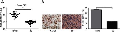 Figure 1 The expression of ERβ in OS and adjacent normal tissues of 24 OS patients detected by qRT-PCR and IHC. (A) Relative expression of ERβ at mRNA level (qRT-PCR); (B) positive stained cells (Bar =50 μm, ×200). ***P<0.001.Abbreviations: ERβ, estrogen receptor β; OS, ostemsarcoma; qRT-PCR, quantitative real-time PCR; IHC, immunohistochemistry.