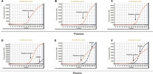 Figure 3 ARMS-PCR for EGFR intracellular mutations detection.Notes: (A), (B), (C) EGFR intracellular mutation cannot be detected in NO.6, NO.11, and NO.12 patient platelets. (D), (E), and (F) EGFR intracellular mutation can be detected in NO.6, NO.11, and NO.12 patient plasma.Abbreviations: ARMS, amplification-refractory mutation system; EGFR, epidermal growth factor receptor.