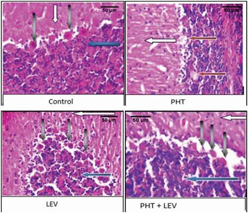 Figure 9. The histomorphology of cerebellum following PHT, LEV and PHT+ LEV adjunctive treatment in male Wistar rats