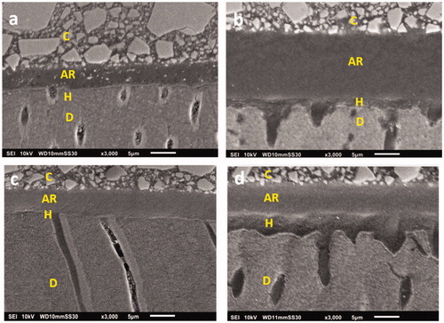 Figure 4. Representative SEM images indicating the difference in adhesive layers of experimental groups at baseline; a) ABU-S; b) CUQ-PA; c) SBU-S; d) SBU-PA. The adhesive layer ranged 5 to 20 µm in thickness among universal adhesive groups. The low-density interfacial zone (so-called hybrid layer) showed 3–5 µm thickness with PA etching (b, d), but appeared as a thin zone (<1 µm thick) under the self-etch mode (a, c). Demineralization effects of PA, creating a serrated pattern and wide-open dentinal tubules with tubular resin tag formation were apparent in PA-treated groups (b, d). C: Composite; AR: Adhesive Resin; H: Hybrid Layer; D: Dentin.