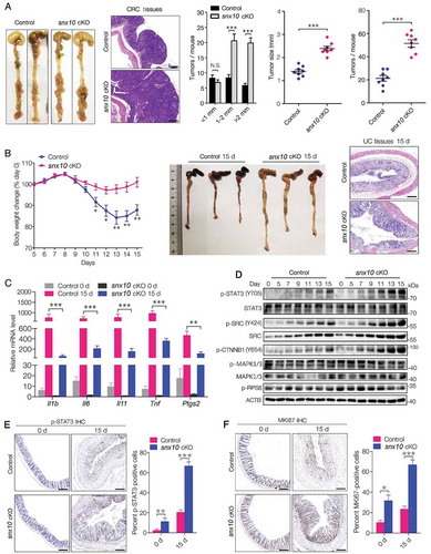 Figure 2. SNX10 deficiency protects against colitis but enhances tumor growth due to increased STAT3 activation in colorectal epithelial cells. (A) From left to right: Representative photograph of tumors in colorectum of control and snx10-cKO CRC mice; Representative H&E images of CRC tissues from control and snx10-cKO mice; Tumor size and number were measured (n = 8). Scale bar: 200 μm. (B) Left panel: Weight loss of mice was measured daily and expressed as the average percentage of initial body weight (n = 10). Middle panel: Length of colons from control and snx10-cKO mice was measured at day 15 of the CAC model. Right panel: Representative H&E images of colon inflammation of control and snx10-cKO mice at day 15. Scale bar: 500 μm. (C) Relative cytokine mRNA levels in colorectal epithelium from control and snx10-cKO mice at day 0 and day 15 (n = 10). (D) Representative immunoblots of the indicated proteins in colorectal epithelium at the indicated times. (E and F) Representative IHC images of p-STAT3 and MKI67 in colorectum at day 0 and day 15 from control and snx10-cKO mice. Scale bar: 500 μm. Data are represented as mean ± SEM. NS, not significant; *, p < 0.05; **, p < 0.01; ***, p < 0.001; by 2-tailed, unpaired t-test.