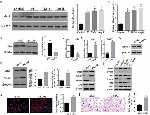 Figure 3. LXRα expression regulates the myocardial hypertrophy markers in H9C2 cells