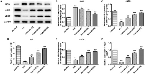 Figure 4. Honokiol altered the levels of iNOS, eNOS, VEGF and NO in PIH rats. (A) Western blot of protein levels of iNOS, eNOS and VEGF in rat placentas and relative expression (B, C, E). (F) Expression of VEGF mRNA detected by RT-qPCR. (D) NO levels measured using a NO assay kit. Honokiol doses: 200 μg/kg (L), 600 μg/kg (M) and 2000 μg/kg (H). Note: Data are expressed as (mean ± SD) [n = 10]; error bars represent standard deviation (±SD). ***p < 0.001 compared with the control group. ##p < 0.01 and ###p < 0.001 compared with PIH group.