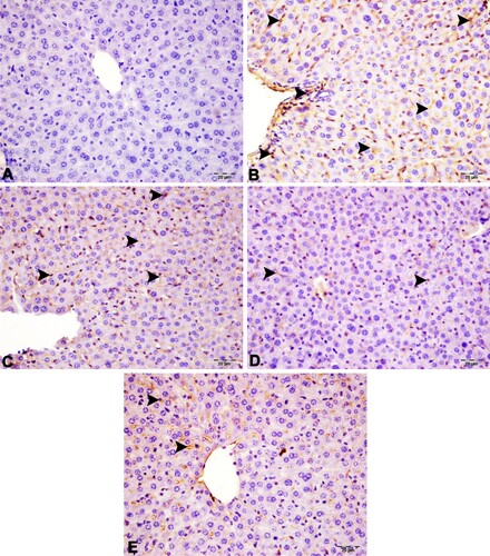 Figure 4. IL-33 expression of liver sections. A (Sham group): Negative IL-33 expression, B (Sepsis group): Severe IL-33 expression in mononuclear cells cytoplasm, portal and sinusoidal spaces (arrowheads), C (OSJ 150 group): Moderate IL-33 expression in portal and sinusoidal spaces (arrowheads), D (OSJ 300 group): Mild IL-33 expression (arrowheads) in the portal and sinusoidal spaces, E (REFgroup): Mild IL-33 expression (arrowheads) in the portal and sinusoidal spaces, IHC-P, Bar: 20µm
