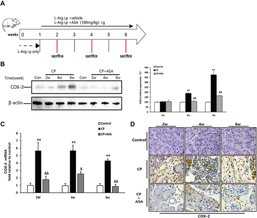 Figure 2 Aspirin inhibits the expression of COX-2 in mice with chronic pancreatitis induced by L-arginine. (A) Schematic diagram of animal experiment with 20% L-arginine induced CP. (B) COX-2 protein expression in pancreatic tissues was detected by Western blot. β-actin served as a loading control (representative blot). (C) COX-2 mRNA expression in pancreas was determined by real time PCR. Fold change values were normalized to β-actin mRNA (each group, n=6). Compared with control: **P<0.01; Compared with CP model group: ΔP<0.05, ΔΔP<0.01. (D) The expression of COX-2 in pancreas by immunohistochemistry staining (original magnification: 200×).