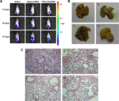 Figure 11 In vivo antitumor metastatic effect on 4Tl-bearing breast cancer mice model.Notes: (A) Tumor metastatic situation was observed by bioluminescence at 15 days, 22 days, and 27 days, respectively. (B) The lung tissue photos of 4Tl-bearing mice respectively treated with saline (b), naked siRNA (c) and PEG-CS/siRNA nanoparticles (d), lung tissue of normal mice was taken as control (a). (C) H&E stained lung section of 4Tl-bearing mice treated with saline (b), naked siRNA (c) and PEG-CS/siRNA nanoparticles (d), lung tissue of normal mice was taken as control (a). Circled areas show the metastatic areas.Abbreviations: H&E, hematoxylin and eosin; PEG-CS, polyethylene glycol-chitosan; siRNA, small interfering RNA.
