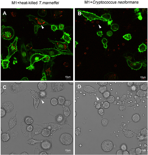 Figure 3 Live-cell imaging of CD86-EGFP-THP-1 cells infected with heat-killed T. marneffei and Cryptococcus neoformans by confocal microscopy. (A) CD86-EGFP-THP-1 cells (green) were incubated for 24 hours with DIL-labeled heat-killed T. marneffei conidia (red). It showed that there was no green fluorescence appearing in the heat-killed T. marneffei conidia. (B) For 24 hours, DIL-labeled C. neoformans (red) infected CD86-EGFP-THP-1 cells (green). It showed that C. neoformans organisms did not bind the CD86-EGFP protein. (C) The image of A observed under bright field. (D) The image of B observed under bright field (original magnification: ×630).