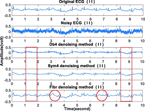 Figure 7. The denoising result under the noise with expected amplitude of 0.065 V.