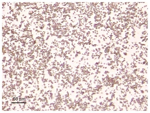 Figure 2 The size of prepared microbubbles were 2 to 5 μm in diameter and cystic with very good dispersity under microscope 400×.