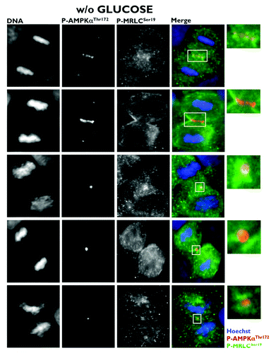 Figure 3. Co-localization analysis of phospho-AMPKαThr172 and phospho-MRLCSer19 during mitosis and cytokinesis in glucose-starved A431 epidermoid cancer cells. Figure shows representative portions of glucose-starved (18 h), cell dividing-containing images captured on a BD PathwayTM 855 Bioimager System with a 40x objective in different channels for phospho-AMPKThr172 (red), phospho-MRCLSer19 (green) and Hoechst 33258 (blue) and merged using BD AttovisionTM software. The rectangular regions (white line) are enlarged and shown as high magnification insets.