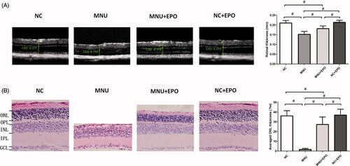 Figure 3. (A) The SD-OCT examination suggested the retinal architecture of MNU group was significantly devastated by MNU administration. The retinal thickness of MNU group was significantly smaller than the normal controls. The retinal thickness of the EPO treated group was smaller than the normal controls. However, the retinal thickness of the EPO treated group was larger than that in the MNU group. The retinal thickness of the normal + EPO group was not significantly different from the normal controls. (B) The ONL of the MNU group disappeared after MNU administration. Conversely, a large proportion of ONL was retained in the retinas of EPO treated group. The mean ONL thickness of the EPO treated group was significantly smaller than the normal controls. However, the mean ONL thickness of the EPO treated group was significantly larger than the MNU group. The mean ONL thickness of the Normal + EPO group was not significantly different from the normal controls (#p < .01, for differences compared between animal groups; all the values were presented as mean ± SD; ONL: outer nuclear layer; OPL: outer plexiform layer; INL: inner nuclear layer; IPL: inner plexiform layer; GCL: ganglion cell layer).