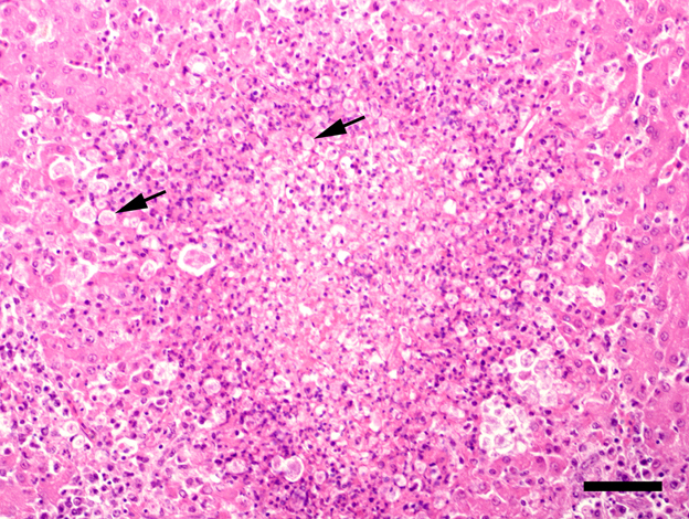 Figure 2.  Tissue section from the liver of the first Red-breasted Merganser, focal tissue necrosis and inflammation associated with numerous tetratrichomonads (arrows). Haematoxylin and eosin stain. Bar = 50 µm.