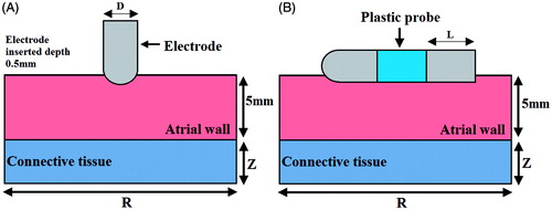 Figure 2. The geometry of the computational model (not to scale). The thickness of the atrial wall is 5 mm. Electrode diameter D = 2.31 mm (7 Fr), electrode length L = 4 mm, insertion depth 0.5 mm and electrode spacing 4 mm.