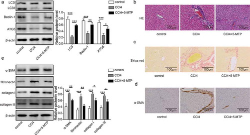 Figure 6.. 5-MTP attenuated CCl4-induced hepatic fibrosis in vivo.