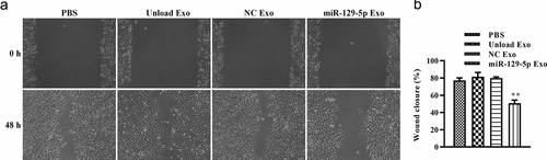 Figure 5. Effect of miR-129-5p-loaded exosomes on tumor cell migration. (a) The lateral migration of colon cancer cells was analyzed using a scratch wound-healing assay. (b) The percentage of wound closure of colon cancer cells. **P < 0.01 vs NC Exo