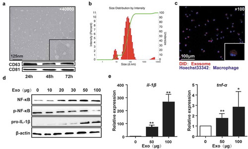 Figure 1. HCC-derived exosomes activated macrophages.Transmission electron microscopy (TEM) of exosomes isolated from the supernatant of Hepa1-6 cells and the expression of exosome-specific markers CD63 and CD81 analyzed by western blotting (a). Size distribution and concentration of exosomes were measured by Nanoparticle Tracking Analysis (b). The representative phase-contrast images of peritoneal macrophages incubated with DiD-labeled exosomes for 30 min (c). Western blot showed the activation of NF-κB (2 h) and pro-IL-1β (12 h) in PMs co-cultured with exosomes (d). Gene expression of il-1β and tnf-α in PMs treated with exosomes for 24h was measured by qPCR (e). Exo, exosomes. Data were representative of three independent experiments, statistical significance was determined as ***p < 0.001, **p < 0.01 and *p < 0.05 compared with control.