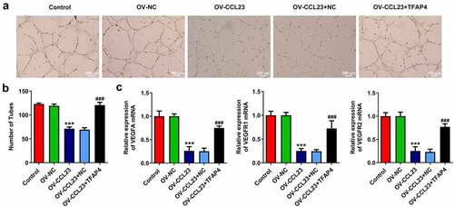 Figure 5. Overexpression of CCL23 inhibits angiogenesis in hepatocellular carcinoma. (a and b) Representative images of capillary-like structures formed by human umbilical vein endothelial cells on Matrigel. (c) Detection of VEGFA, VEGFR1 and VEGFR2 mRNA levels in Huh-7 cells. The results are representative of at least three independent experiments. ***P < 0.001 vs. control group; ###P < 0.001 vs. Ov-CCL23 group.