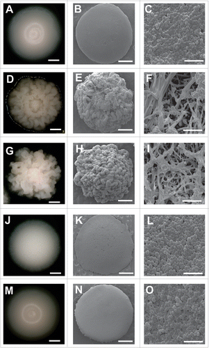 Figure 1. Representative colonies of five phenotypes from isolate 49.07 of C. tropicalis (A) parental smooth colony; (D) crepe colony; (G) rough colony; (J) revertant of crepe (RC) and (M) revertant of rough (RR) were photographed using a stereoscopic microscope (Nikon SMZ-745). Scanning electron micrographs showing the microarchitecture of colonies following 96 h incubation on YPD agar at 28°C: (B) electron micrograph of the parental smooth colony; (E) electron micrograph of crepe variant colony; (H) electron micrograph of rough variant colony; (K) electron micrograph of the revertant of crepe colony and (N) electron micrograph of revertant of rough colony. Electron micrographs of cells types: (C) cells from parental smooth colony; (F) cells from crepe variant colony; (I) cells from rough variant colony; (L) cells from revertant of crepe colony and (O) cells from revertant of rough colony. White bar: 2 mm (A,D,G,J,M); 1 mm (B,E,H,K,N); 20µm (C,F,I,L,O).