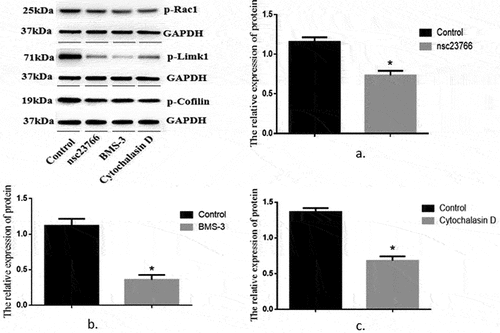 Figure 2. Relative expression levels of P-RAC1, P-Limk1 and P-Cofilin proteins in the control group and the Rac1, Limk1 and Cofilin inhibitor group.