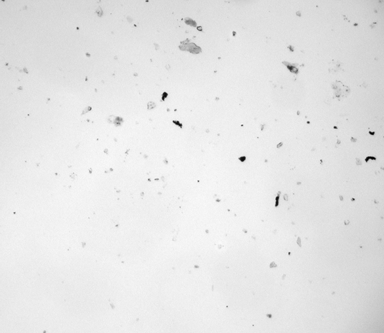 FIG. 5 The corner of a typical AOC sample trace at 100× magnification. The edges of the sample trace were diffuse and the 2 mm × 14.5 mm area often varied between samples.