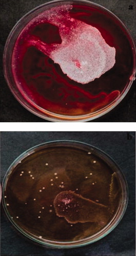 Figure 4. Nystatin inhibits the twitching motility of A17: (a) twitching motility of the isolate A17; (b) inhibition of the twitching motility by nystatin.