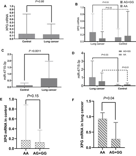 Figure 1 (A) The levels of XPG mRNA in peripheral blood between control and lung cancer; (B) Genotypic difference (rs873601) of XPGm RNA in peripheral blood between control and lung cancer; (C) The miR-4715-3p level in peripheral blood between control and lung cancer; (D) Genotypic contribution to miR-4715-3p difference; (E) Genotypic difference of XPG mRNA in control; (F) Genotypic difference of XPG mRNA in lung cancer.