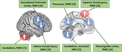 Figure 2. Summary of group differences between familial risk (FR) for psychosis and controls in functional and structural MRI studies in the Northern Finland Birth Cohort 1986. Blue represents decreased fMRI/MRI signal in FR (vs. controls) and red represents an increase in fMRI/MRI signal in FR (vs. controls)