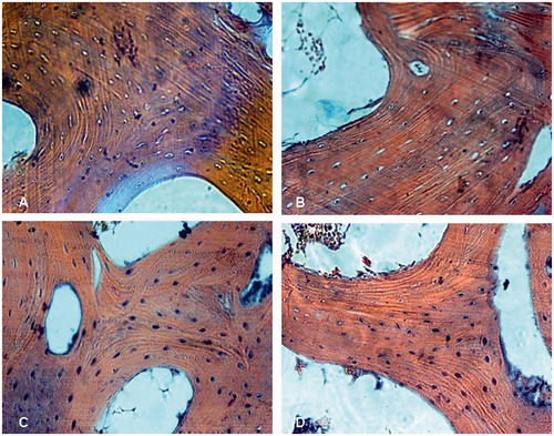 Figure 1. A subchondral area of the femoral head is shown. At 8 weeks, significantly increased number of empty osteocyte lacunae was found in group M (A) treated with steroid only and group Con (B) treated with both steroid and the vector carrying irrelative sequence, while less empty osteocyte lacunae were found in group S (C) treated with both steroid and adenovirus shuttle vectors carrying siRNA targeting the PPARγ gene and group N (D) with no treatment (Stain, hematoxylin and eosin; original magnification, ×400).