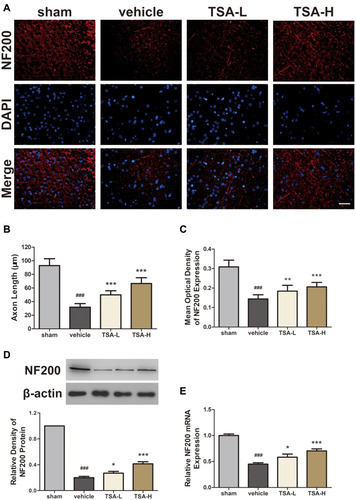Figure 5 TSA increased axonal length and promoted NF200 expression. (A) Immunofluorescence staining for NF200, scale bar= 50μm. (B) The changes in the length of axons in different groups. (C) The mean optical density of NF200 in different groups. (D) The protein expression of NF200 in different groups. (E) The mRNA expression of NF200 in different groups; ###P < 0.001 vs the sham group; *P< 0.05, **P < 0.01, ***P < 0.001 vs the vehicle group.