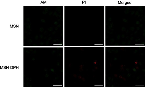 Figure 6 Live/dead images of MGC-803 cells incubated with MSN and MSN-DPH (consist of Dox loaded, TPP attached, HA capped mesoporous silica nanoparticles). Live cells and dead cells were stained by AM (green) and PI (red), respectively. Scale bars denote 25 μm.Abbreviation: MSN, mesoporous silica nanoparticle.