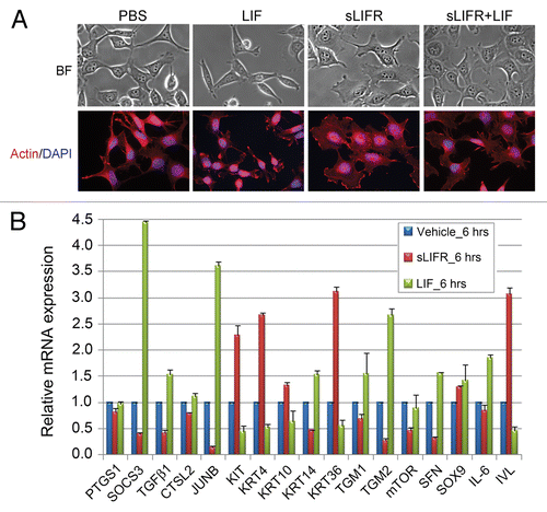 Figure 3. Leukemia inhibitory factor (LIF) treatment induces de-differentiation phenotype of nasopharyngeal carcinoma (NPC) cells. (A) Treatment with LIF or soluble LIFR (sLIFR) induces morphologic changes in NPC-TW06 cells. Upper panels, bright field; lower panels, fluorescent staining of actin (red) and DAPI (blue). (B) mRNA expression of genes associated with epithelial differentiation by QRT-PCR. Values are presented as means ± SD of duplicate samples.