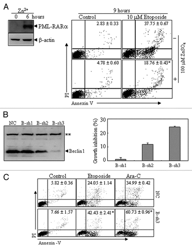 Figure 6 The effects of PML-RARα-induced autophagic activity on apoptosis in leukemic cells. (A) U937/PR9 cells were pre-treated with or without 100 µM ZnSO4 for 6 h, followed by treatment with or without etoposide. Then annexin V+ cells with or without PI staining were detected by flow cytometry. PML-RARα protein induction was also shown. (B) NB4 cells were stably transfected with B-sh1, B-sh2, B-sh3 or NC. The effect of Beclin 1 suppression by shRNAs was analyzed by protein gel blot (left part) and the percentage of growth inhibition against NC cells are shown as means ± SD from three independent experiments (right part). (C) NC- and B-sh3-expressing cells were respectively treated with or without etoposide (1.5 µM), or with Ara-C (2 µM) for 24 h. Then annexin V+ cells with or without PI staining were detected by flow cytometry. In (A and C), the values represent the percentages of the corresponding cells in means ± SD of triplicates from an independent experiment. The symbol * indicates p values of less than 0.01 compared with etoposide-treated U937/PR9 cells without Zn2+ induction (A) or NC cells with corresponding treatments (C). The symbol **points to a nonspecific band. All the experiments were repeated three times and similar results were obtained.