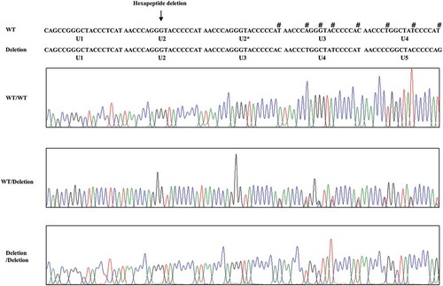 Figure 3. Electropherogram of hexapeptide deletion polymorphism in chicken PRNP gene. Four colors indicate individual bases of DNA sequence using ABI 3730 automatic sequencer (blue: cytosine, red: thymine, black: guanine, green: adenine). Sharps (#) indicate double peaks induced by hexapeptide deletion polymorphism. Arrows indicate the hexapeptide deletion polymorphism (U2) found in this study. WT: wild-type of chicken hexapeptide repeat. Deletion: U2 deletion polymorphisms of chicken hexapeptide repeat.