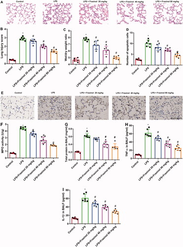 Figure 2. Fraxinol attenuates LPS-induced ALI in mice. (A,B) Histological changes were evaluated by using H&E staining. Bar = 20 μm. (C) The lung W/D ratio was used to assess the pulmonary edoema. (D,E) Apoptotic cells were measured by TUNEL assay. Bar = 20 μm. (F) The level of MPO activity. (G) Effect of fraxinol on total proteins in BALF. (H,I) TNF-α and IL-1β levels in BALF were measured by ELISA kits. *p < 0.05 vs. Control group; #p < 0.05 vs. LPS group.