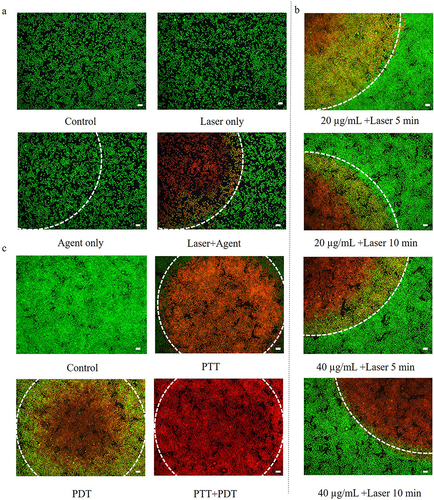 Figure 6 (a) In vitro PTT of the SP94-Fe3O4@ICG&DOX nanoparticles; (b) In vitro photothermal destruction of Hepa1-6 cells treated by various combinations of SP94- Fe3O4@ICG&DOX and NIR laser irradiation (808 nm, 0.6 W/cm2); (c) FL images of Hepa1-6 cells after PDT, PTT and simultaneous PDT/PTT treatments. Viable cells were stained green with Calcein-AM, and dead/later apoptosis cells were floating and eluted, or stained red with PI (Scale bar = 50 µm).