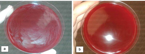 Figure 2. Blood agar inoculated with solutions of AssuriTEA corresponding to (a) 0.78 mg/mL and (b) 12.5 mg/mL