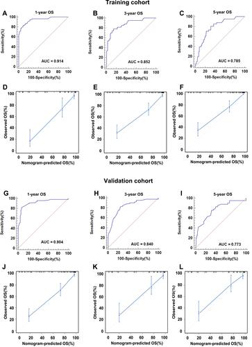 Figure 6 Internal and external validation of the nomogram predicting the OS of CM patients. The AUCs in the training cohort and validation cohort were 0.914, 0.852, 0.785 (A–C) and 0.904, 0.840, 0.773 (G–I), respectively, indicating good discrimination. The calibration plots in the training and validation datasets were shown in (D–F) and (J–L). Both indicated that the nomogram-predicted prognosis compared well with the actual prognosis.