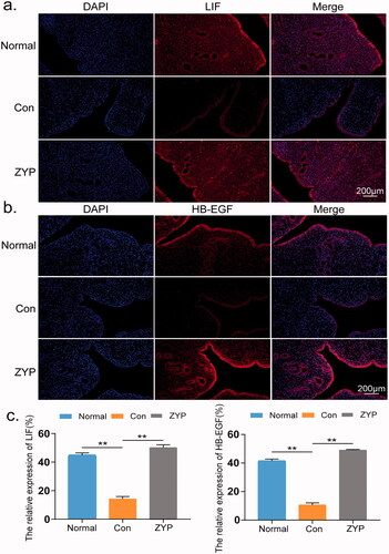 Figure 8. The expression and localization of LIF and HB-EGF in rat endometrium. (*p < 0.05, **p < 0.01) (a) The expression and localization of LIF in rat endometrium. (b) The expression and localization of HB-EGF in rat endometrium. (c) The fluorescence intensity of LIF and HB-EGF of rat endometrium in three groups. Bar = 200 μm; Con: control; ZYP: Zishen Yutai Pill; LIF: leukaemia inhibitory factor; HB-EGF: heparin-binding epidermal growth factor.