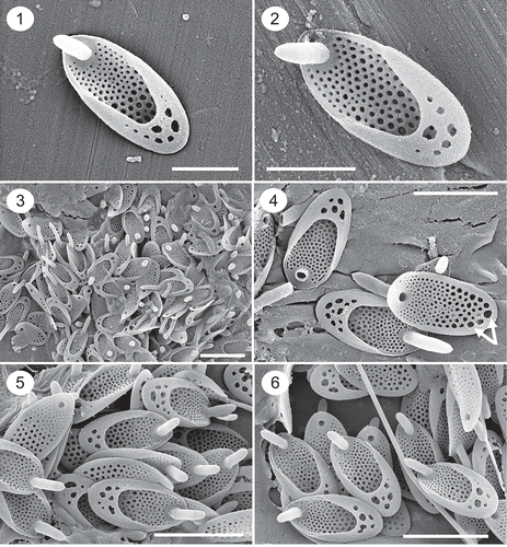 Figs 1–6. SEM images of Synura synuroidea. Figs 1–2. Individual scales illustrating the large posterior rim bearing holes, details of the base plate pores and forward projecting spine. Figs 3–6. Groups of scales from individual cells depicting different numbers and sizes of holes penetrating the posterior rim, and lengths of spines. The undersurface of the scale in Fig. 4 illustrates the differences in the sizes of the base plate pores, and the posterior-most row of large pores situated immediately below the posterior rim (white arrows). Scale: 1 µm (Figs 1–2) and 2 µm (Figs 3–6).