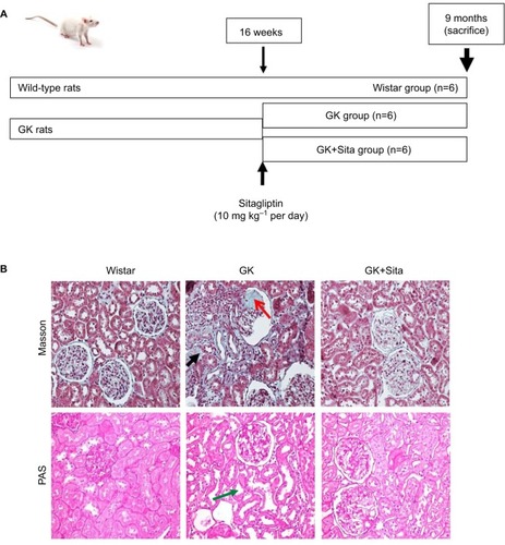 Figure 1 (A) Experimental model schema: at 16 weeks (when the diabetic parameters were developed), some GK rats were injected with sitagliptin (10 mg·kg−1 per day) until sacrifice at 9 months. (B) Kidney Masson’s trichrome and PAS staining: significant glomerulosclerosis and interstitial fibrosis (black arrow) are observed in GK kidney vs. Wistar and Sita group (Kimmelstiel–Wilson nodule, red arrow), and PAS staining shows focal tubular dilation (green arrow).