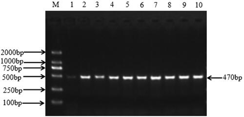 Figure 1. FGB gene PCR amplification products.Note: M: DL2000 DNA marker; 1-10: PCR products.